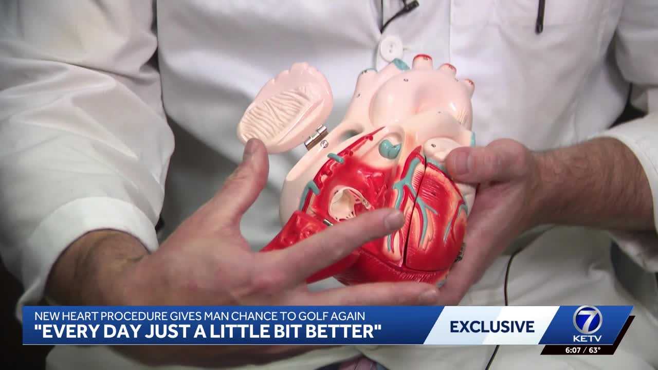 New heart procedure helps man swing a golf club again — WISN 12 Milwaukee, Carrington Community news